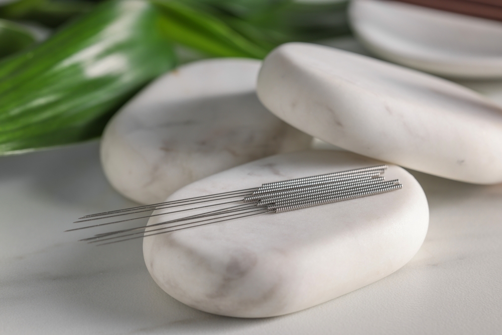 Acupuncture,Needles,And,Spa,Stones,On,White,Table,,Closeup